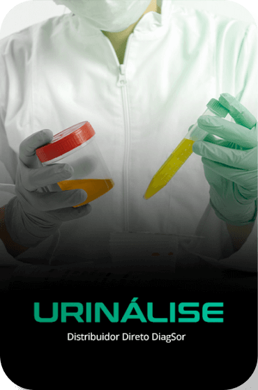 Urinálise