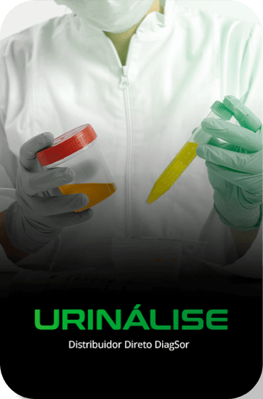 Urinálise
